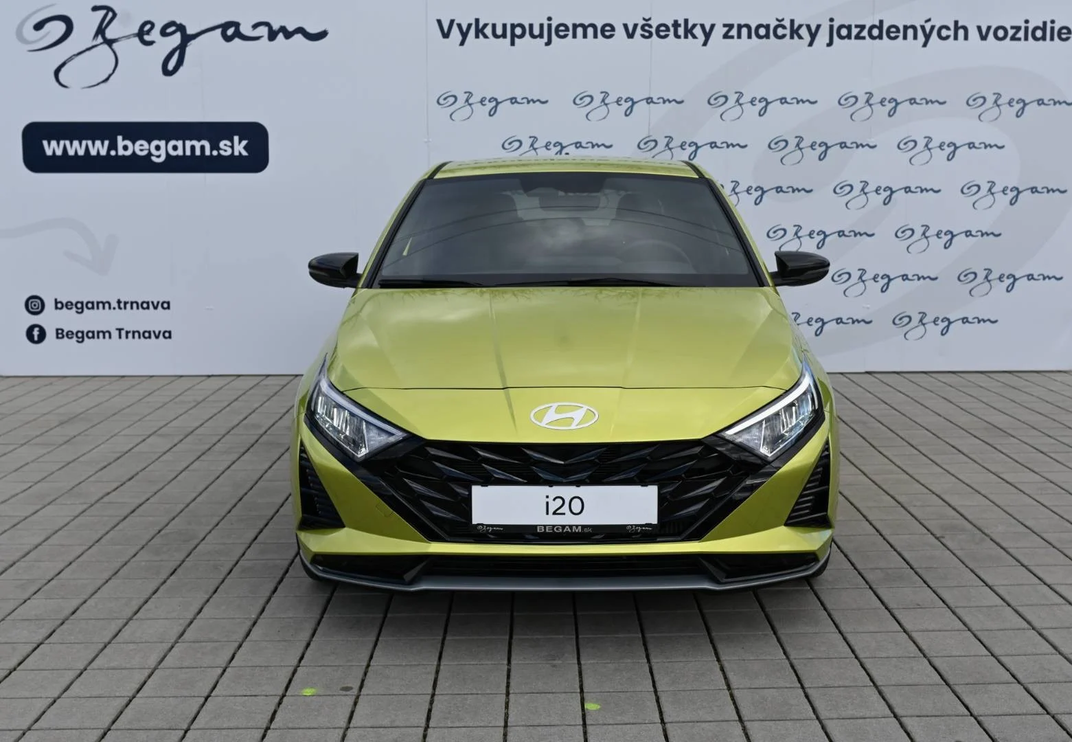 Hyundai i20 1.0 T-GDi Black Edition A/T | Begam Trnava
